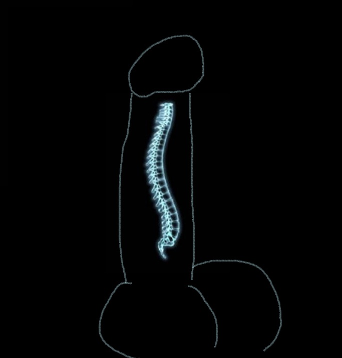 xraydickspine